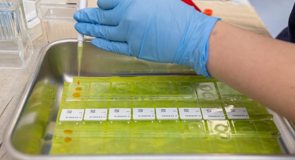 Direkte-Immunfluoreszenzuntersuchung-01