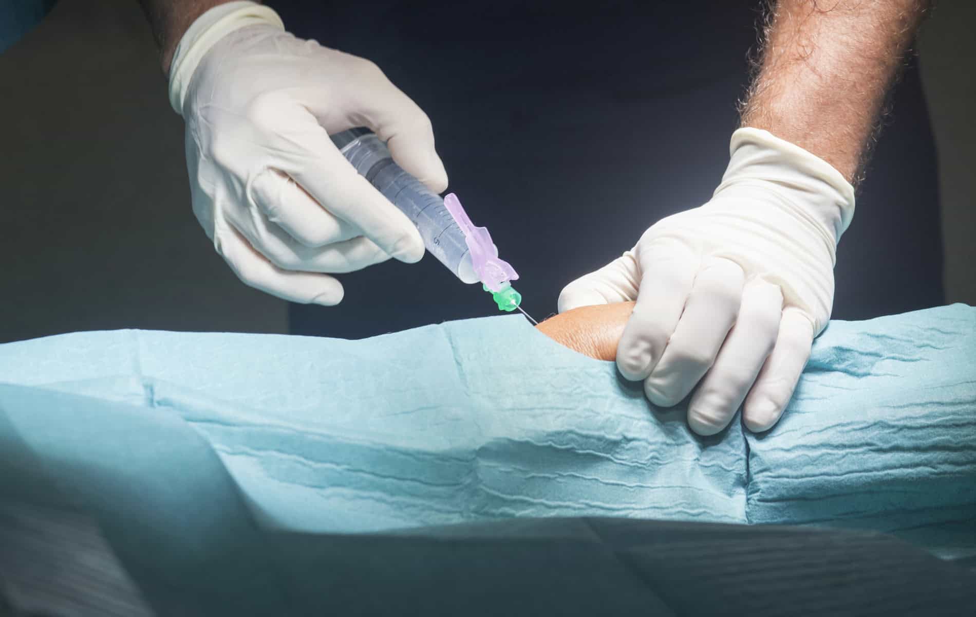 radiosynoviorthese-(rso)