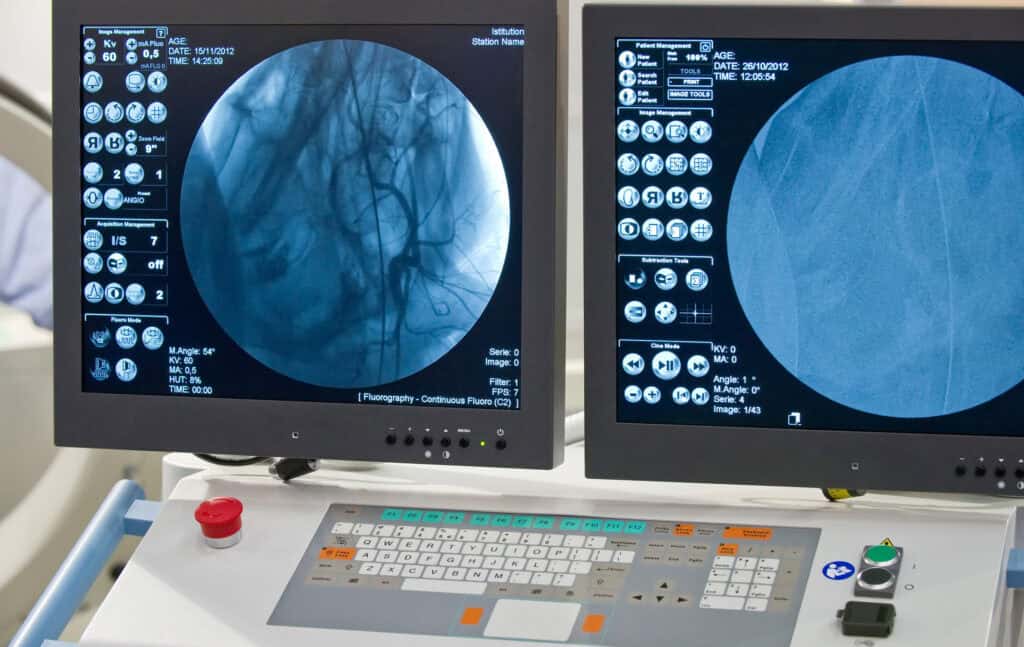 angiographie-gefaessuntersuchung