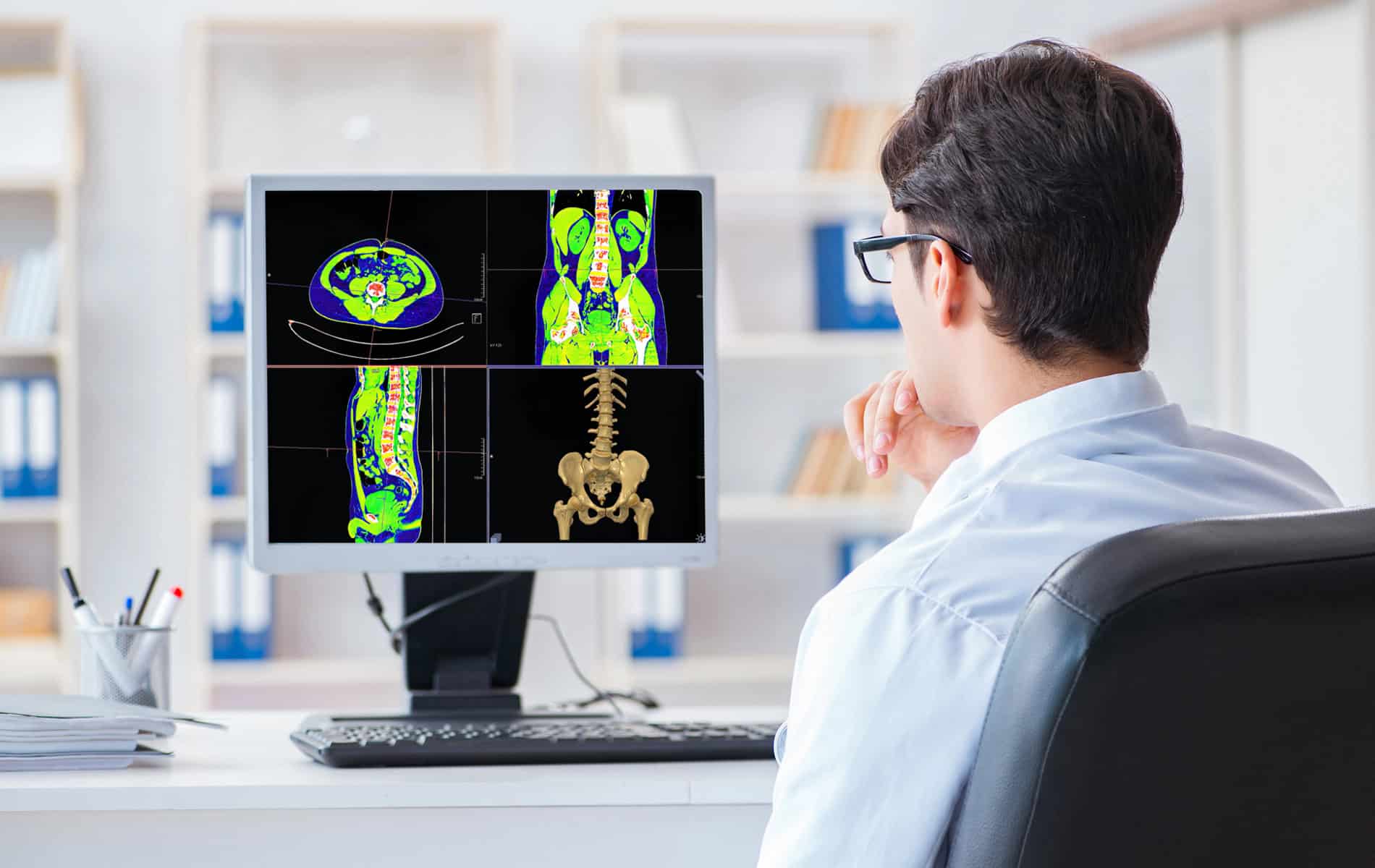 spect-ct-scan-indikationen-ablauf-vorteile-faq