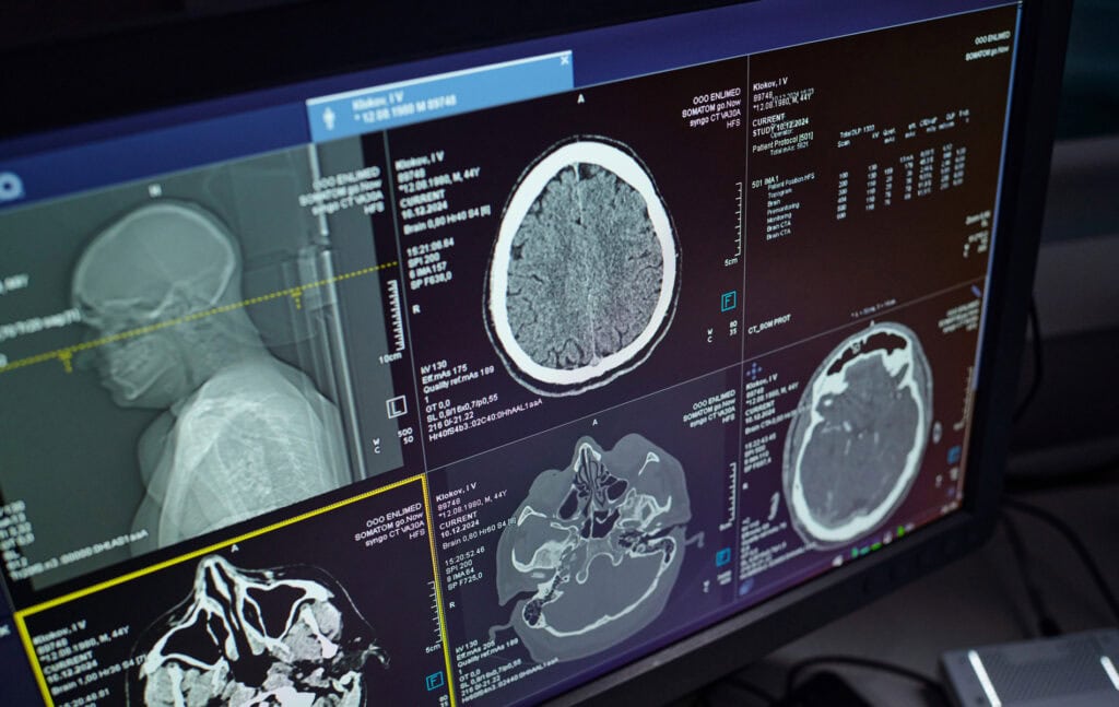 sportmedizinische-diagnostik-radiologie