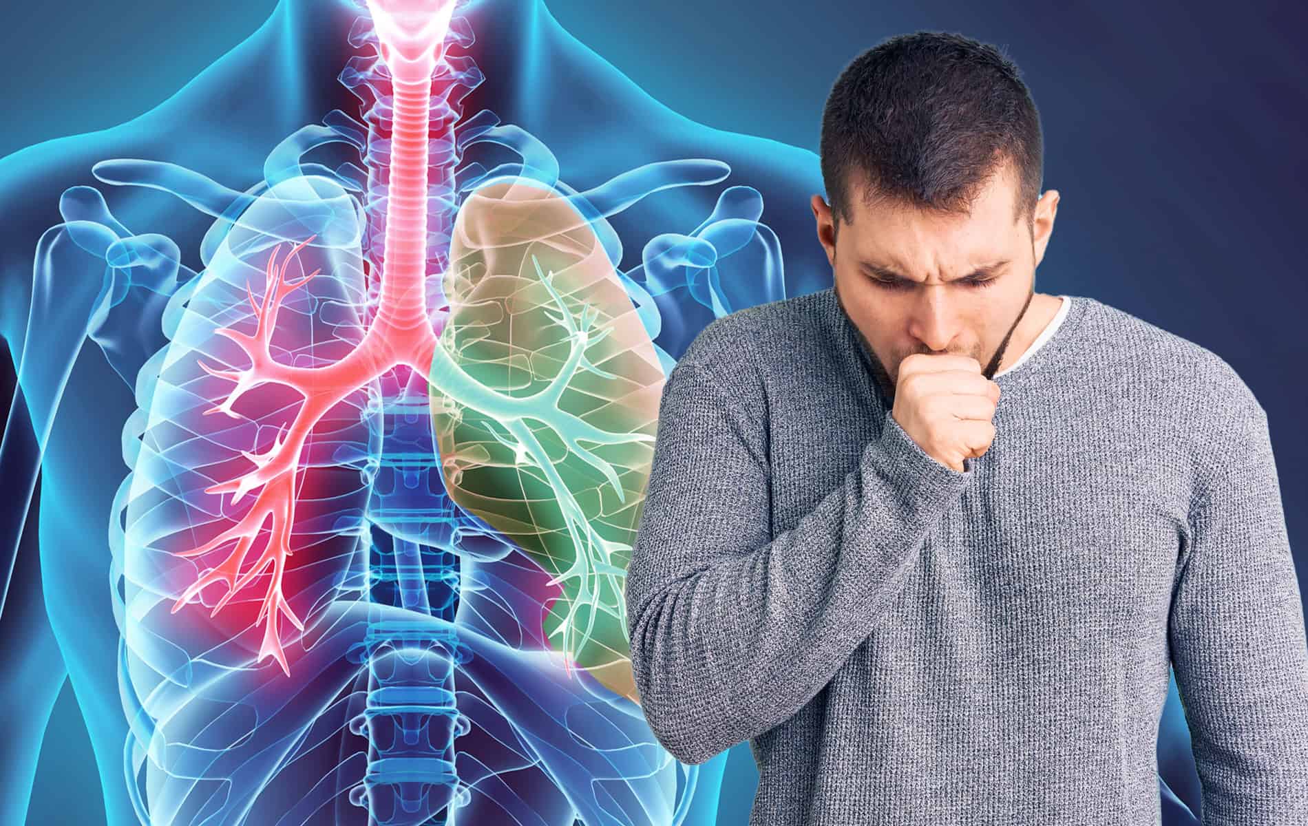 COPD  Ursachen, Risiken, Symptome, Diagnostik & Behandlung