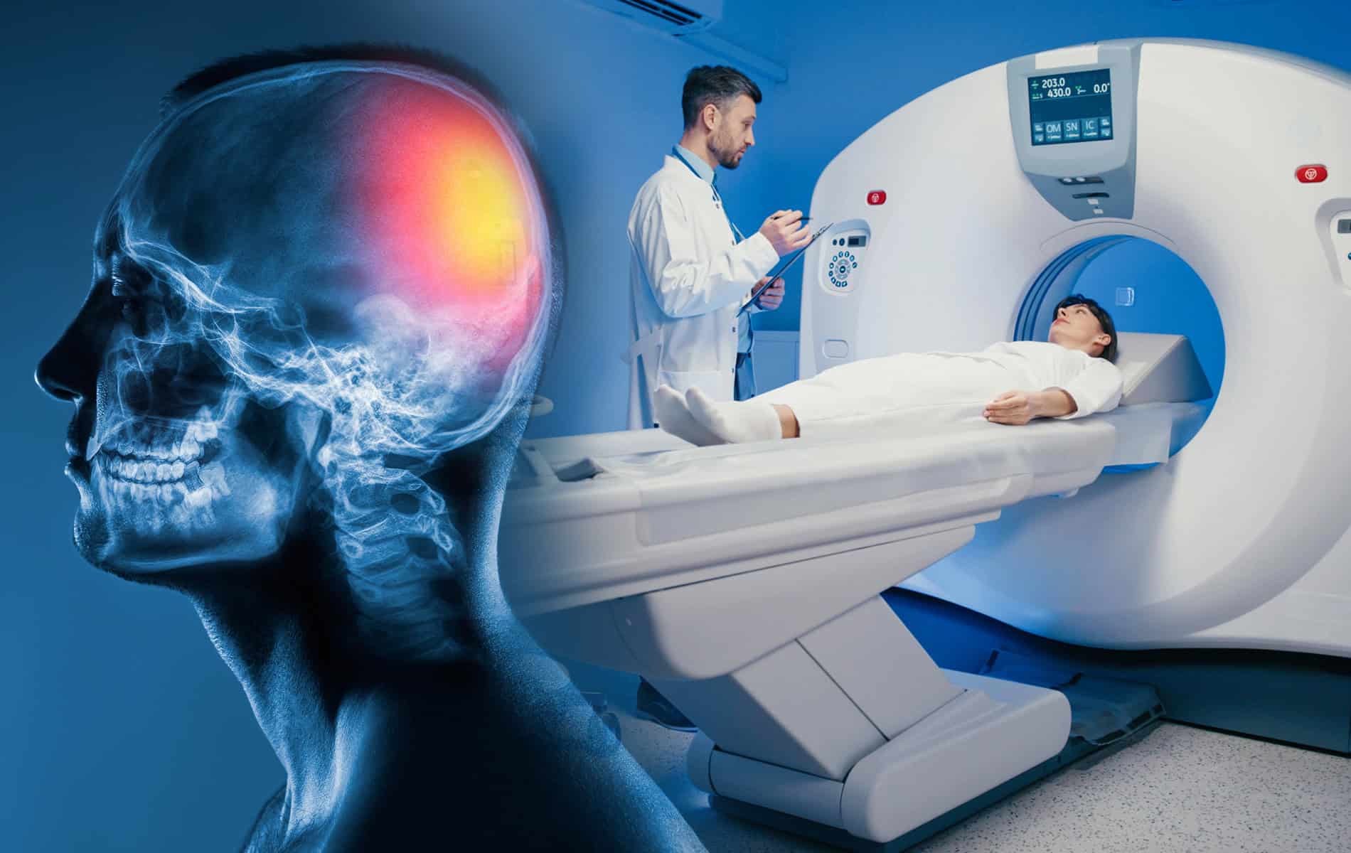 aneurysma-screening-praevention