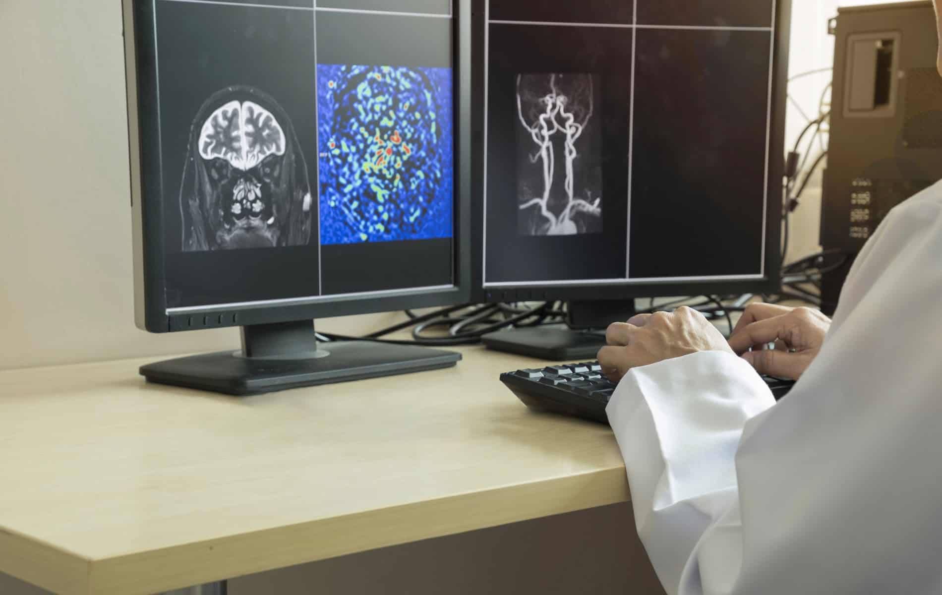 molekulare-bildgebung-radiologie-nuklearmedizin-diagnostik-verfahren-methoden-anwendung