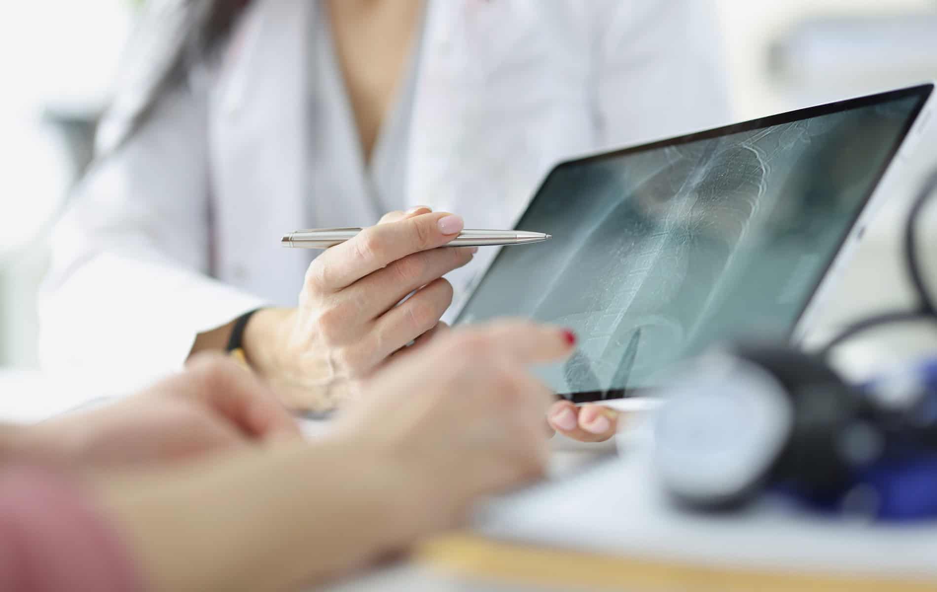 sarkoidose-granulomatoese-entzuendung-ursachen-risikofaktoren-symptome-diagnostik-behandlung