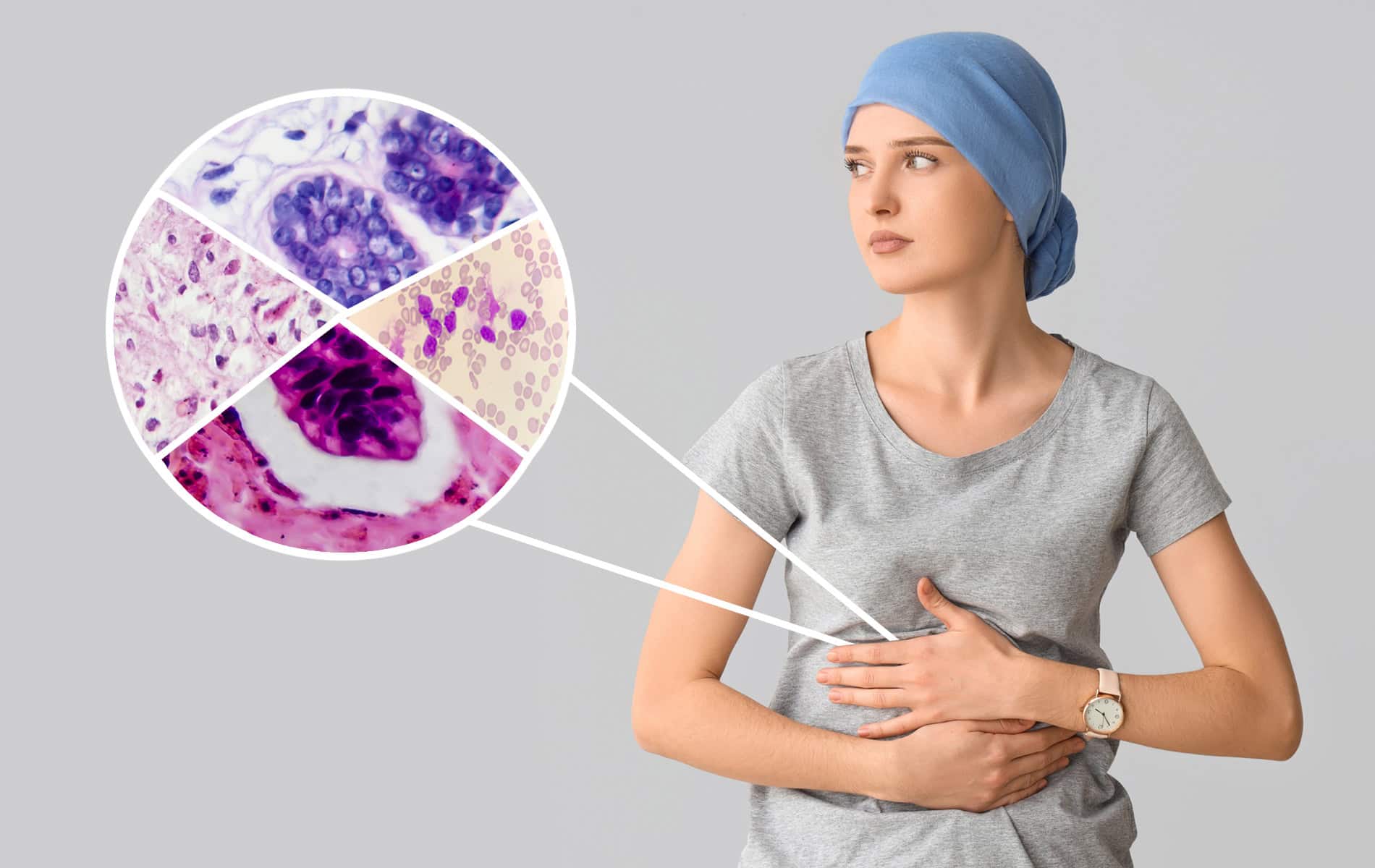 tumorheterogenitaet-verstehen