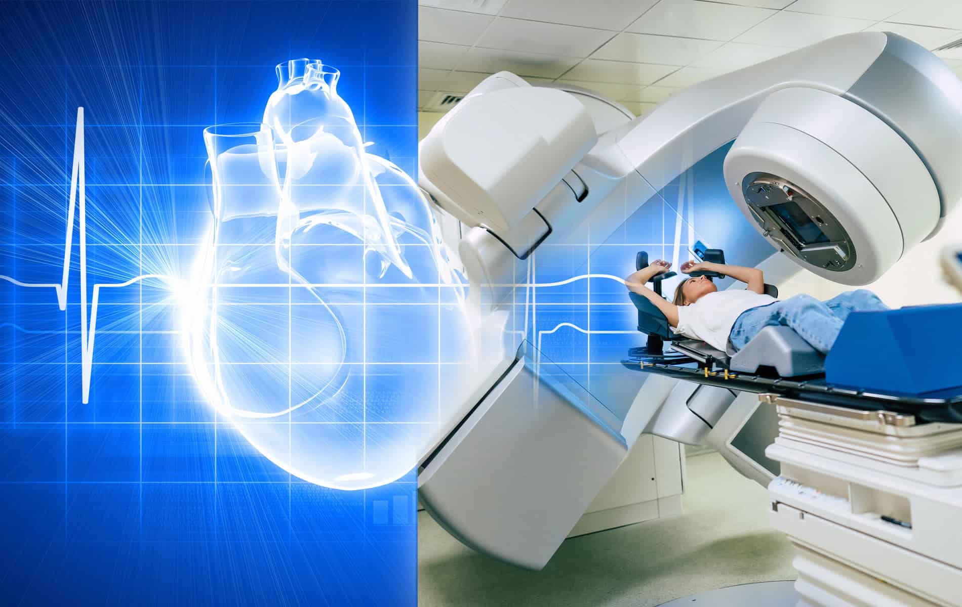 kardiomyopathie-nach-strahlentherapie