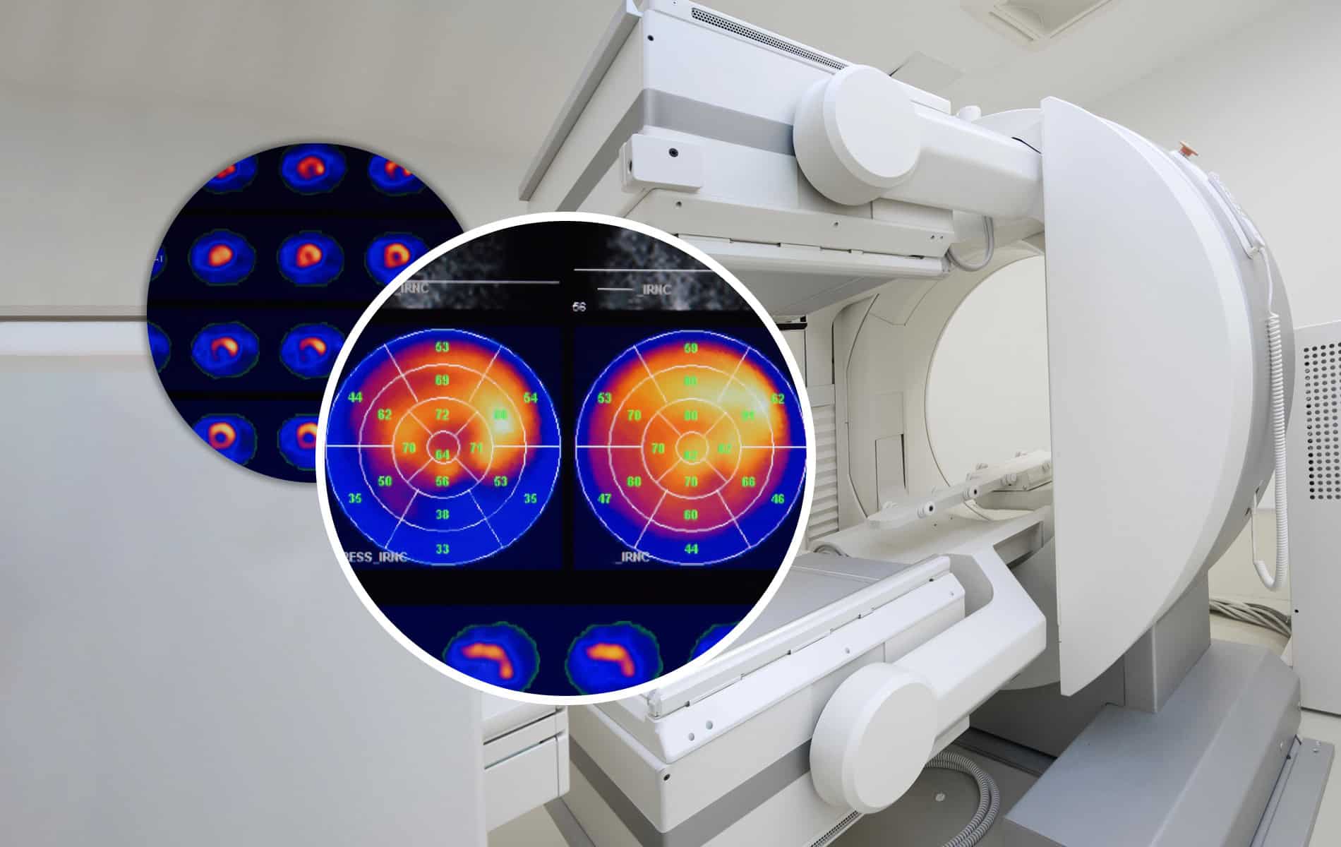 risiken-myokardszintigraphie