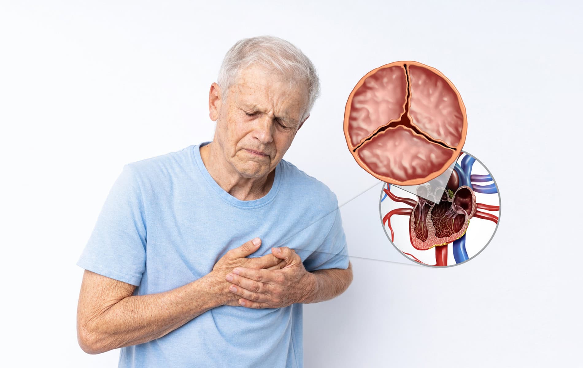 herzklappenerkrankungen_2