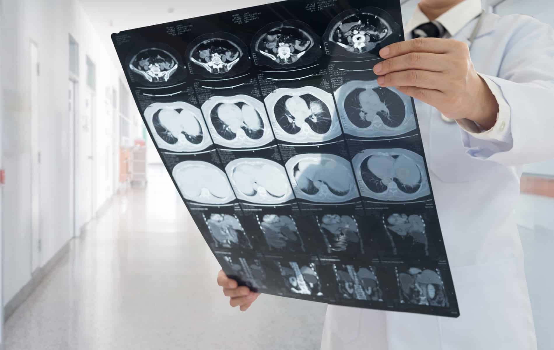 nierenfunktionsstoerungen-niereninsuffizienz-ursachen-symptome-diagnose-behandlung