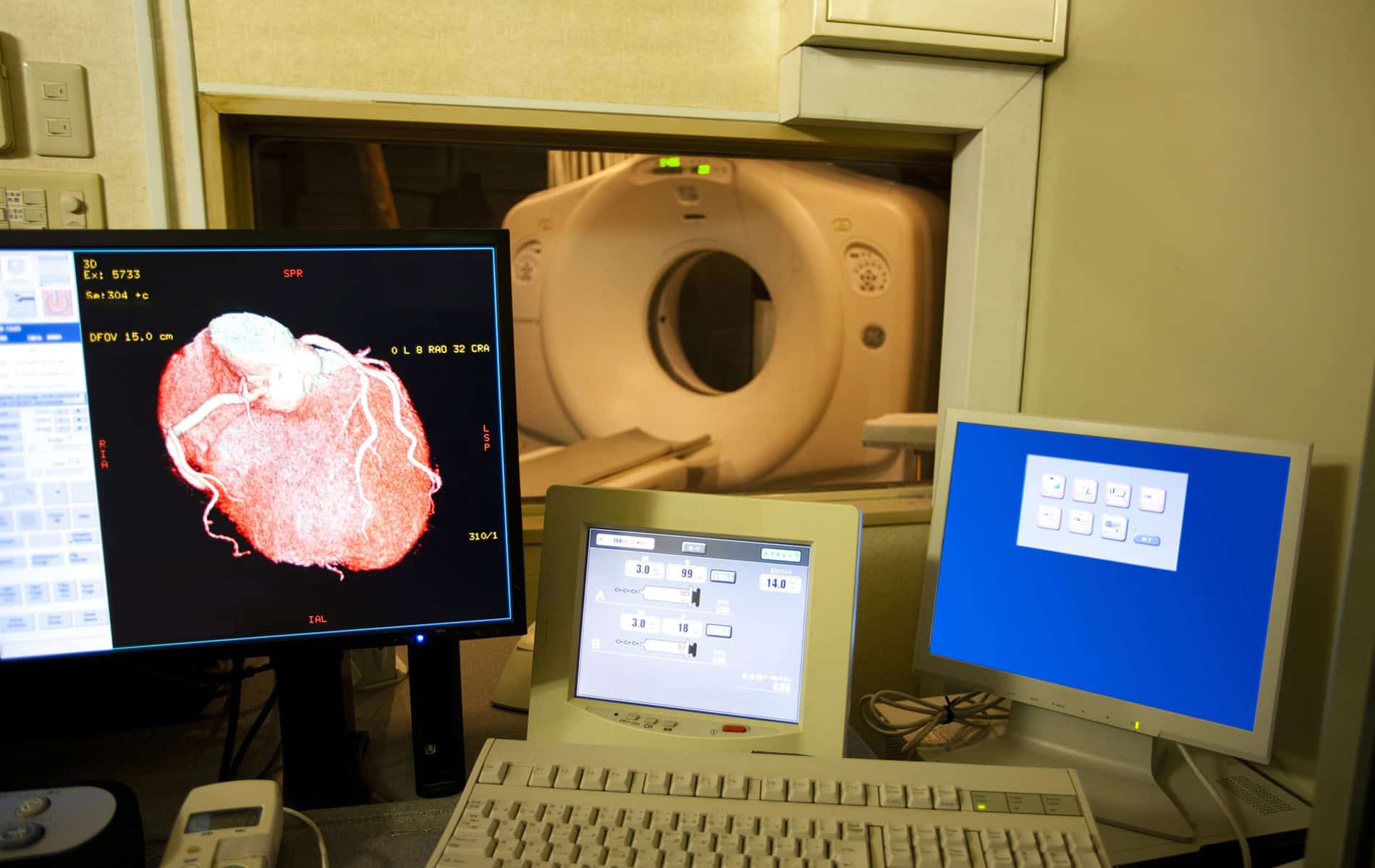angeborene-herzfehler-emah-diagnostik-nachsorge-kontrolle-radiologie-bildgebende-verfahren