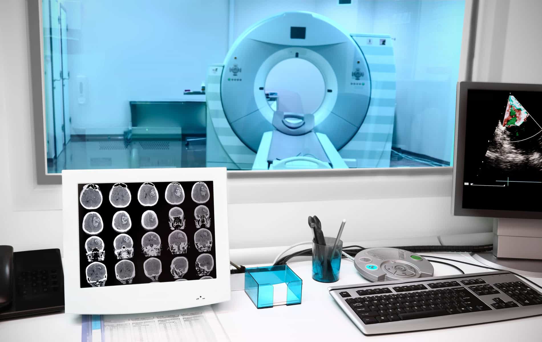 tumor-rezidiv-zweittumor-risiko-diagnostik-therapie-nachsorge