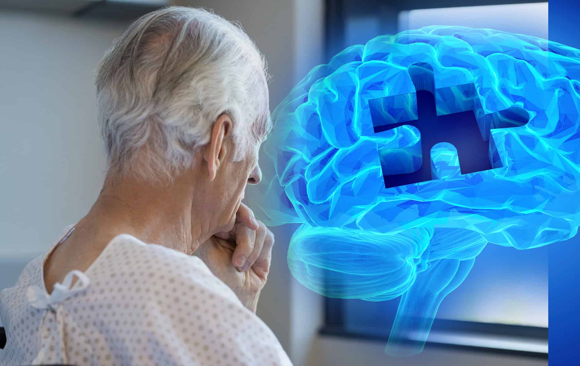 alzheimer-featuredimage