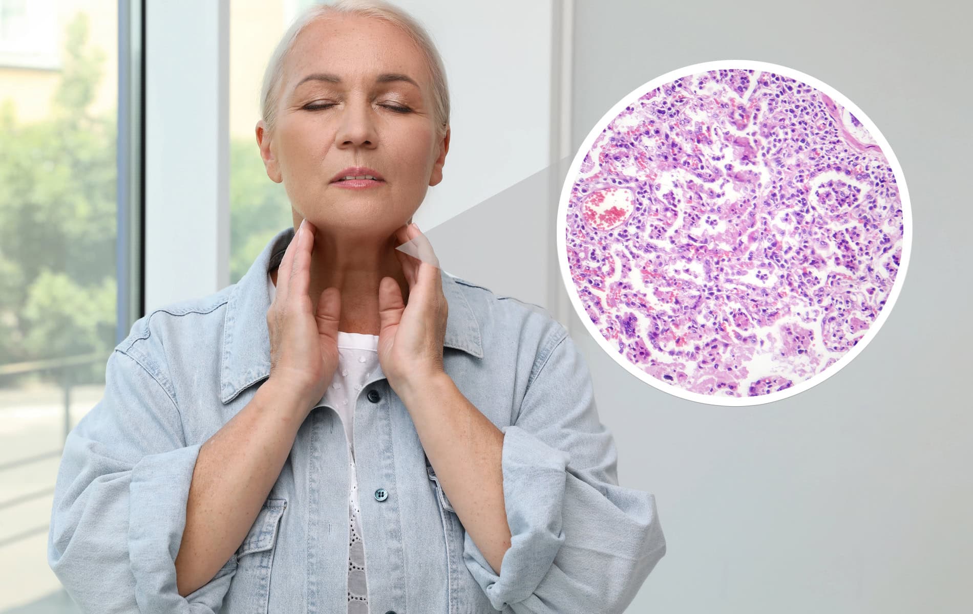 lymphome-(hodgkin-non-hodgkin-lymphome)