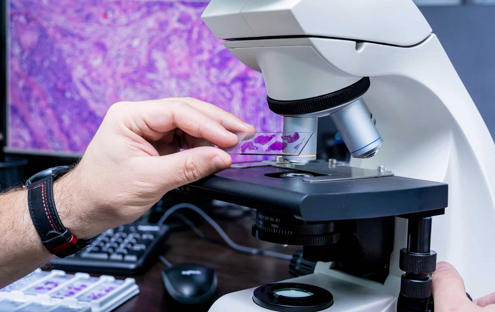 lymphome-hodgkin-non-hodgkin-ursachen-symptome-diagnostik-behandlung