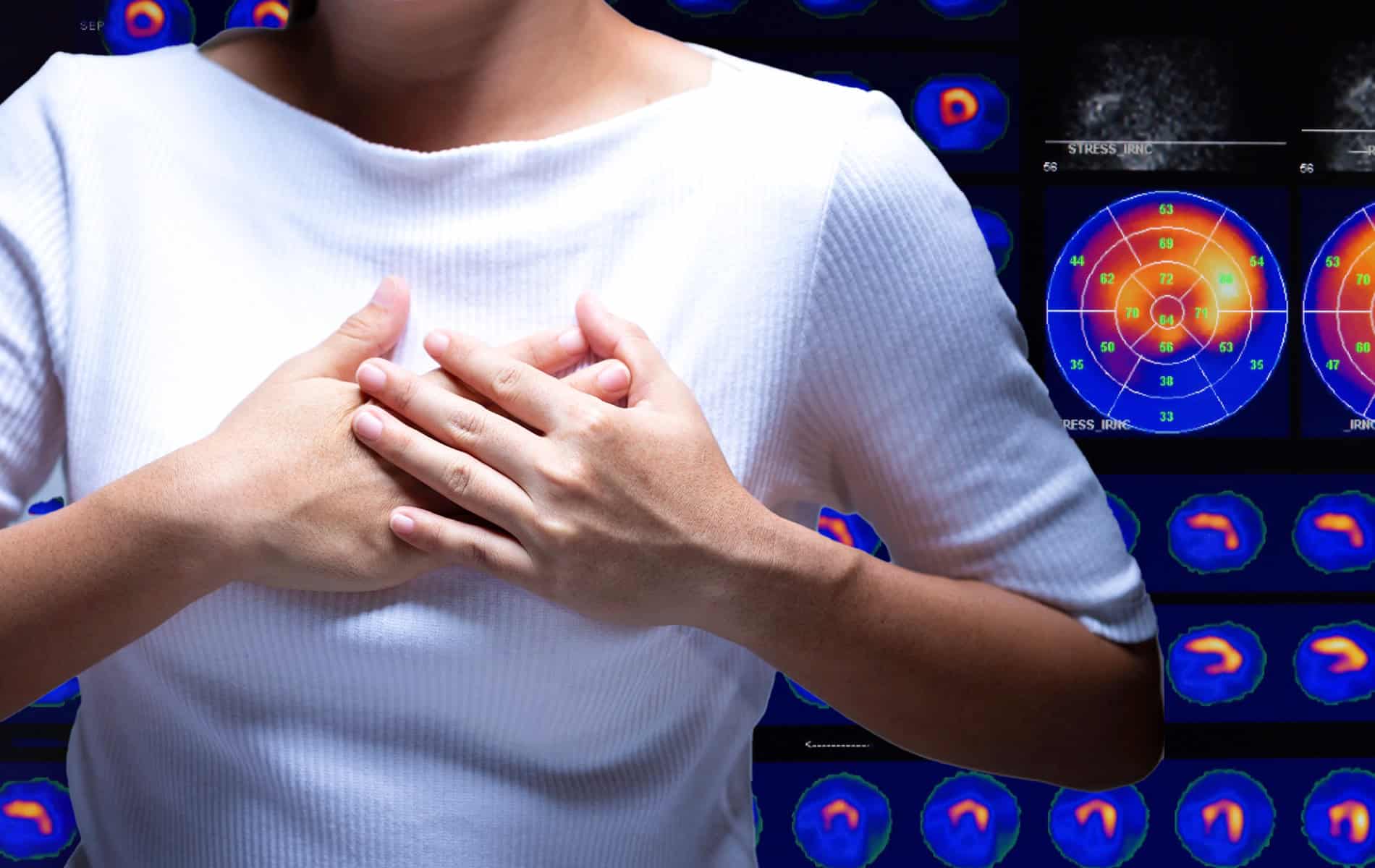 myokard-perfusion-pet-scan-pruefen