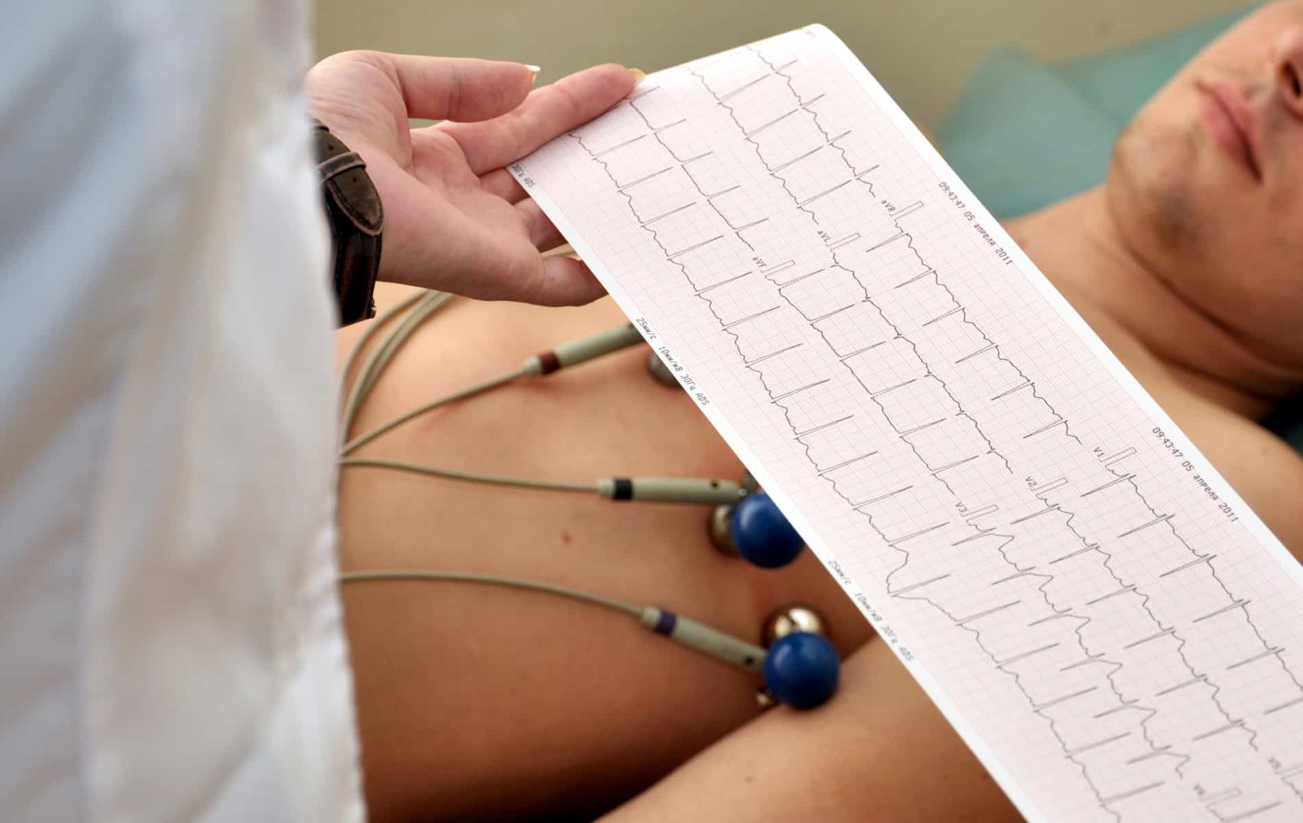 notfalldiagnostik-herzinfarkt-kardio-mrt-ct-herzultraschall-differenzialdiagnostik