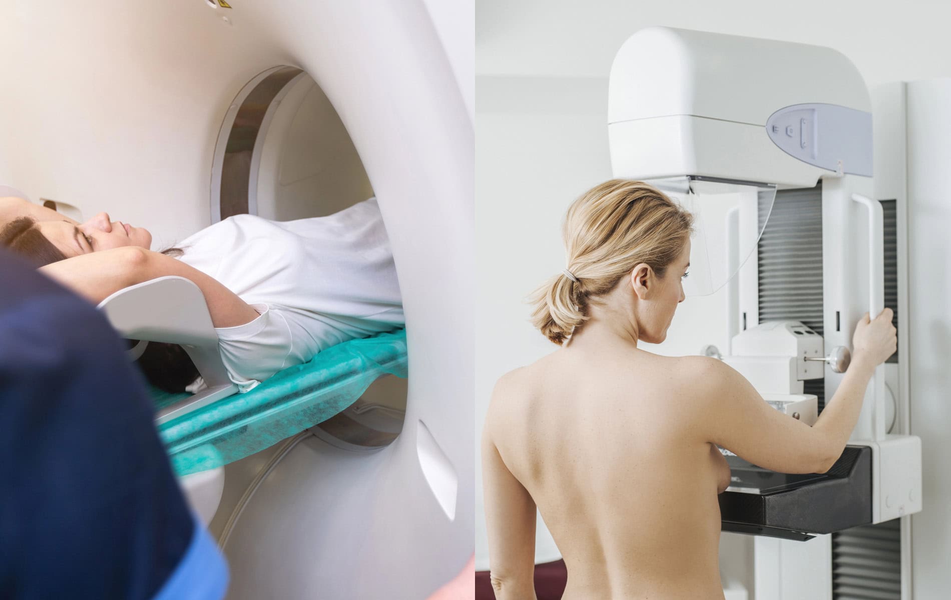 brustknoten-arten-gutartig-boesartig-klaerung-diagnostik-ultraschall-roentgen-ct-mrt