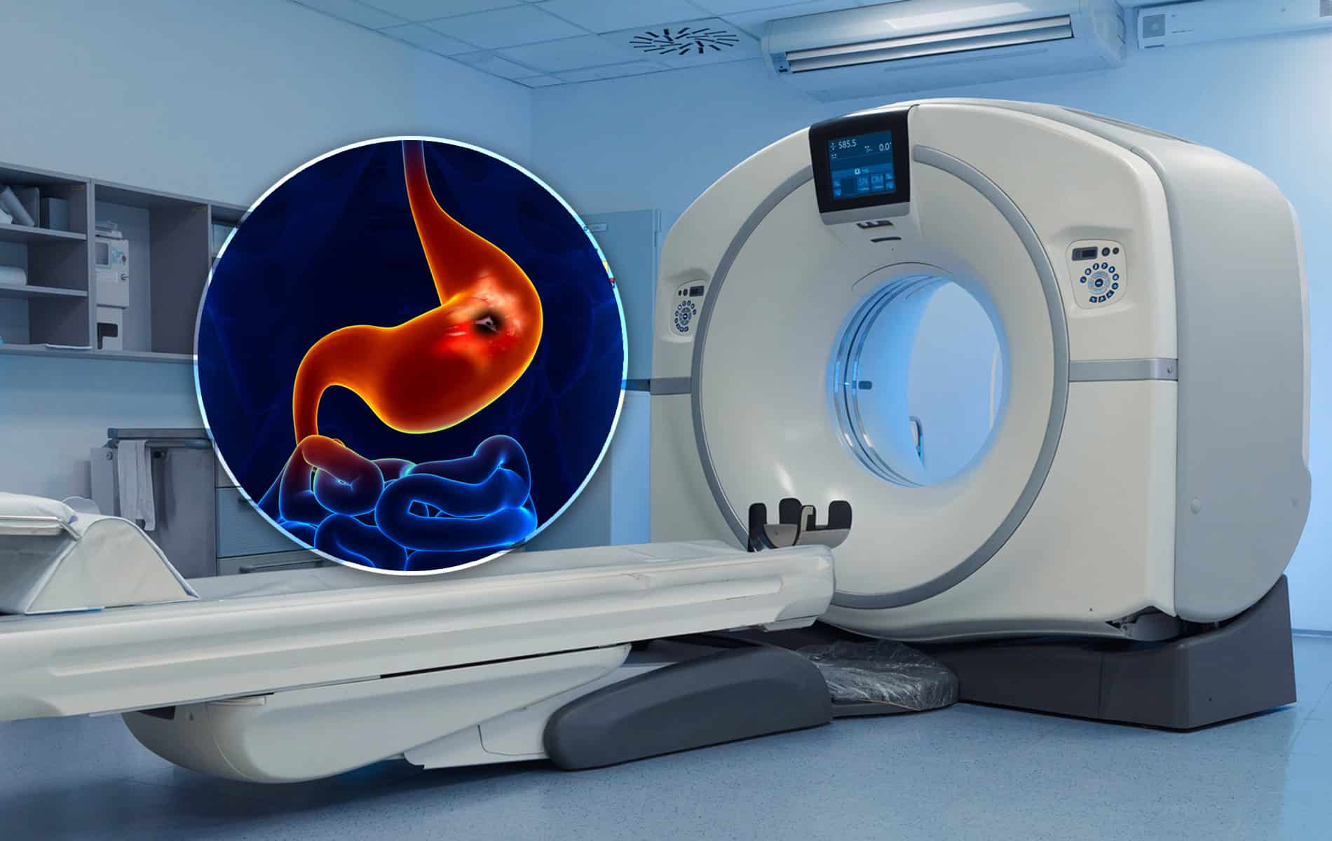 dotatoc-pet-ct-net