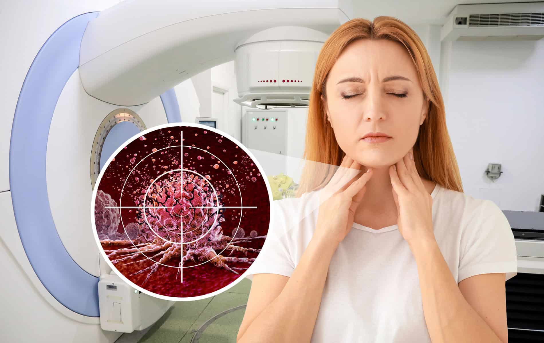 lymphom-strahlentherapie