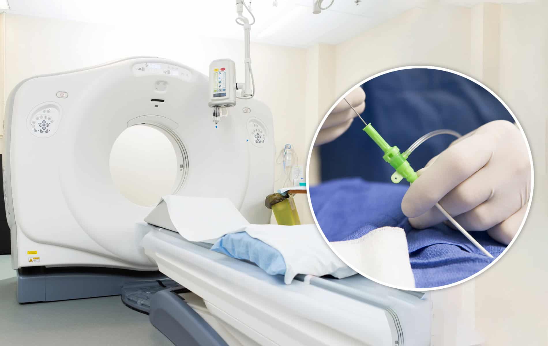 myokarditis-subtypisierung