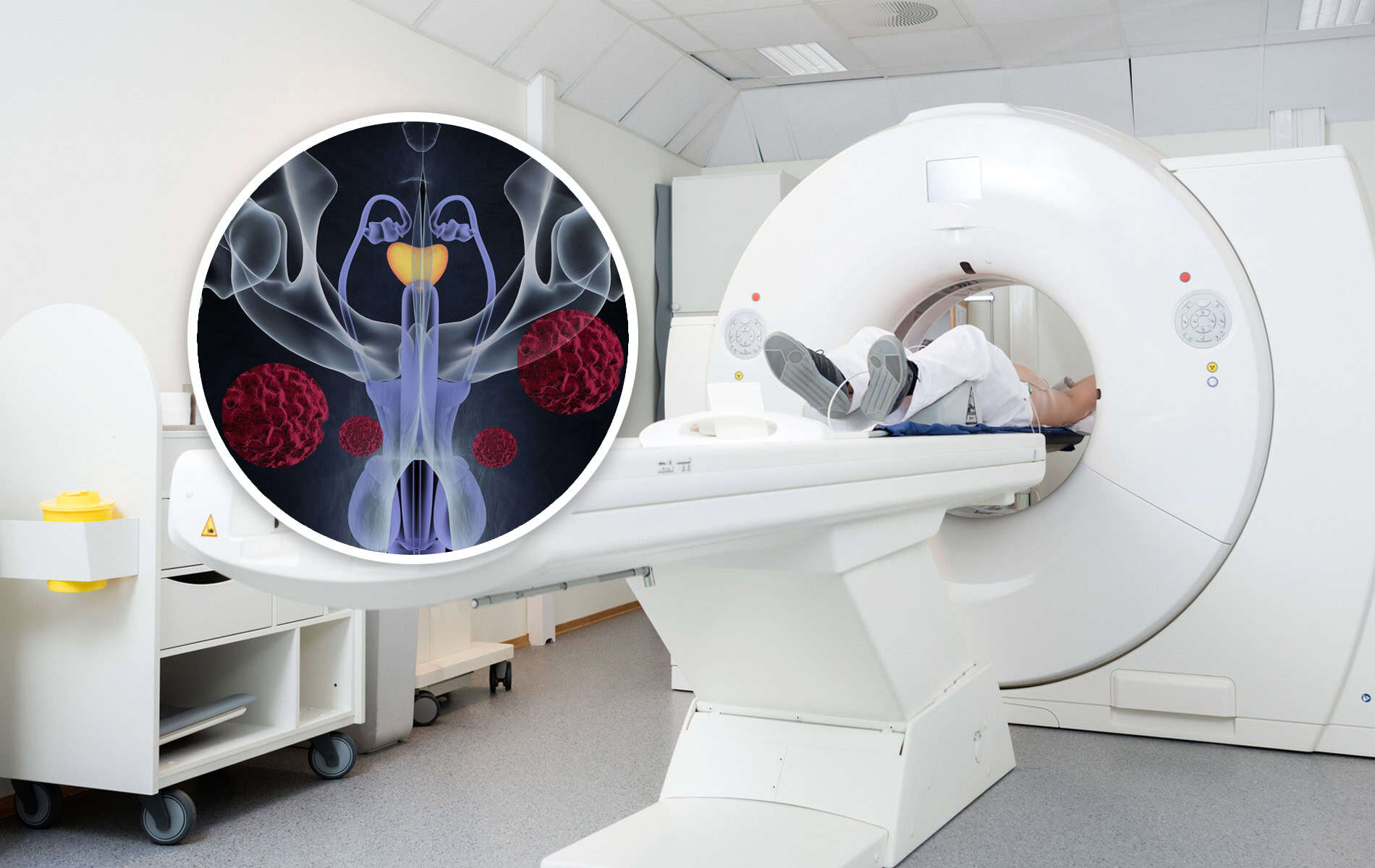 psma-pet-ct-prostatakrebs
