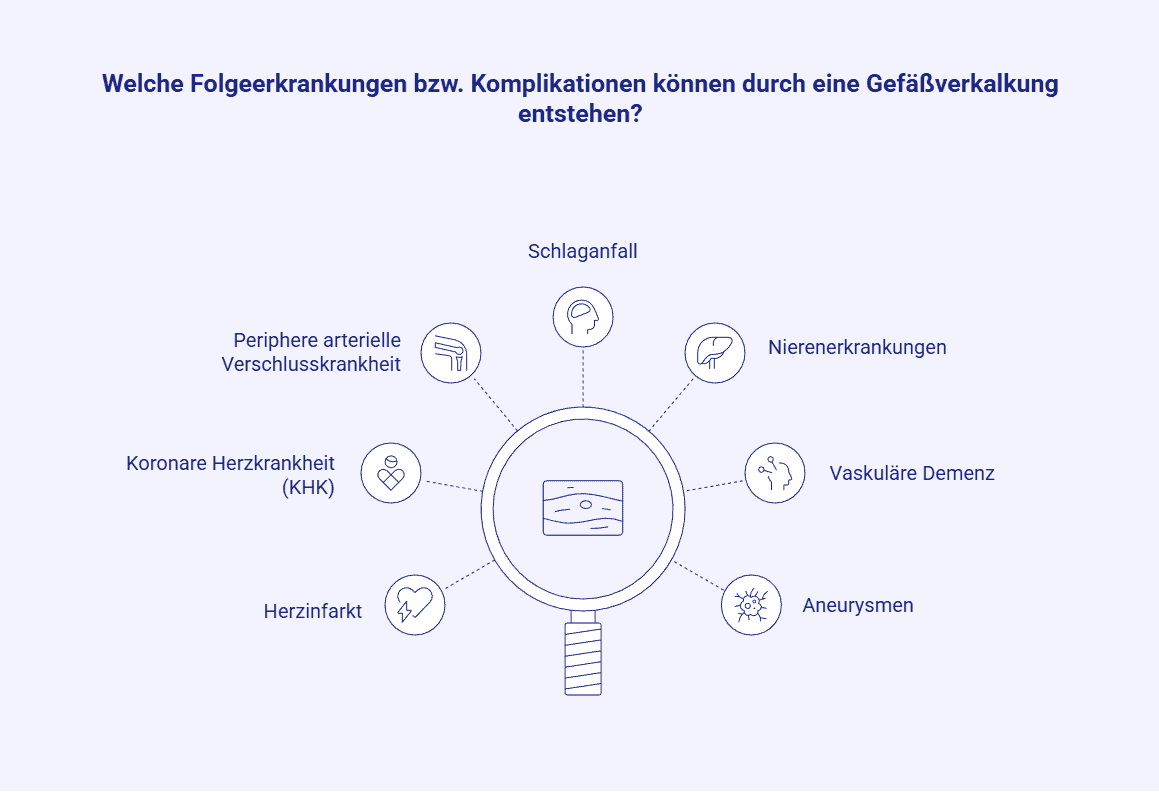 folgeerkrankungen-bzw-komplikationen-koennen-eine-gefaessverkalkung